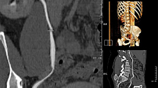 cturogram2