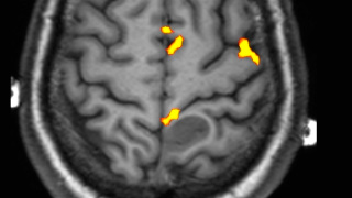 fmri2