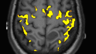 fmri3