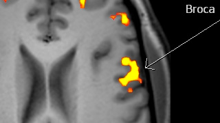 fmri4