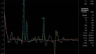 mrspectroscopy2