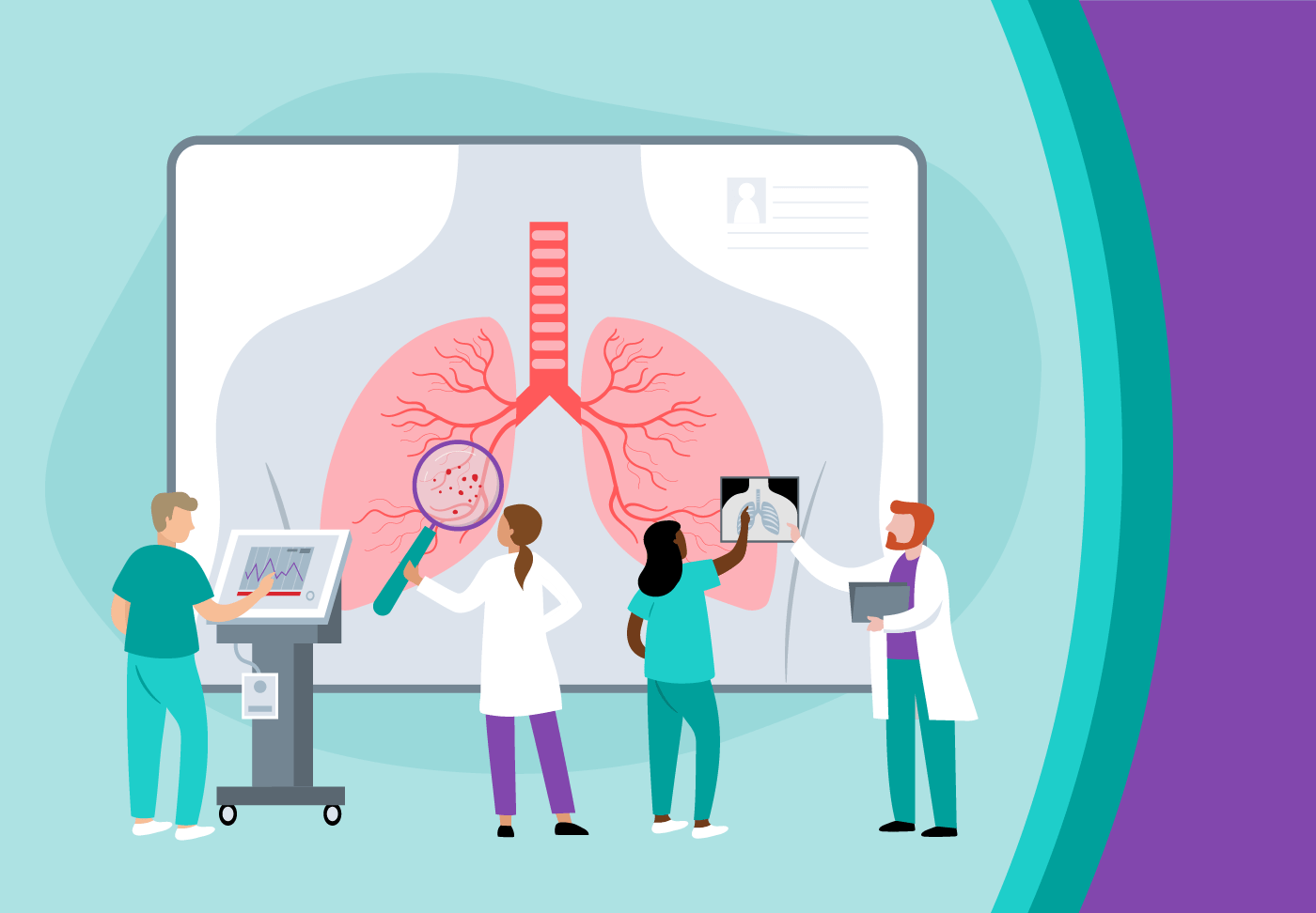 Illustration of physicians reviewing lung cancer image on a screen