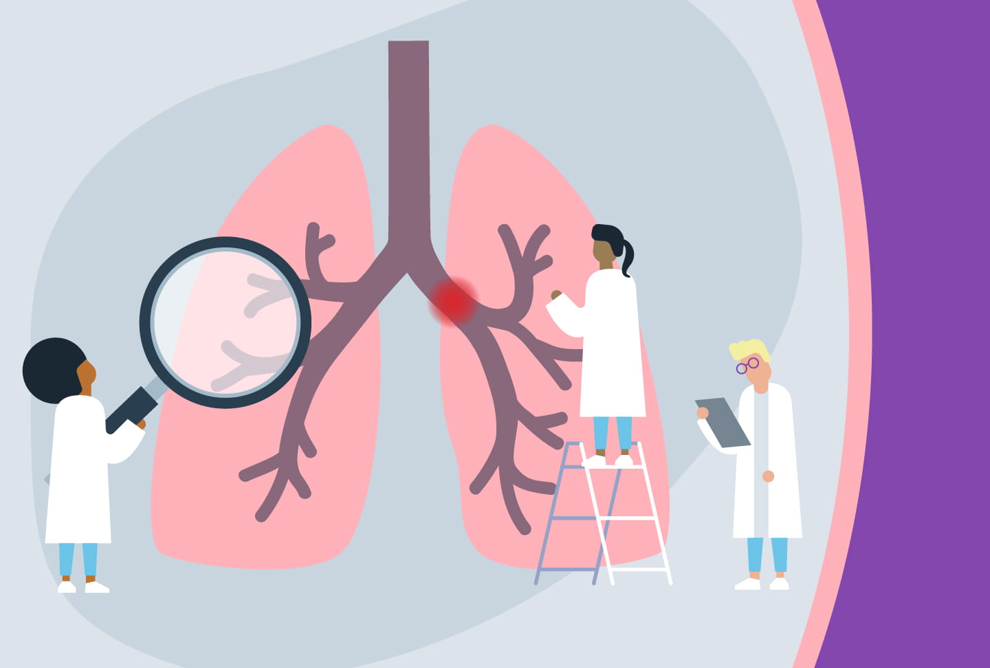 Illustration of providers looking at blocked artery in lung